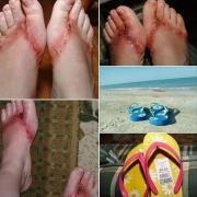 Imagini ȘOCANTE! Cât de rău te pot răni ȘLAPII!