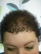 O femeie a primit un semn de la Dumnezeu, după chimioterapie