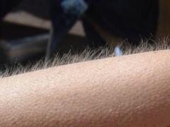 INEDIT! De ce ni se face "pielea de găină"