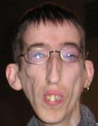 Foto-horror! El este CEL MAI HIDOS BĂRBAT al planetei!