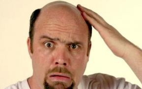 Probleme cu părul? S-a descoperit LEACUL pentru CHELIE