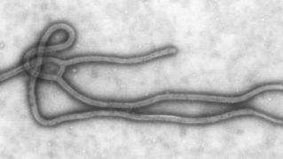 Un tratament REVOLUŢIONAR i-ar fi SALVAT pe cei doi cetăţeni americani de EBOLA
