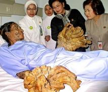 OMUL-COPAC: A şocat o lume întreagă cu înfăţişarea sa SINISTRĂ!