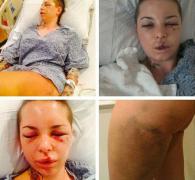 Cum arată o femeie BĂTUTĂ DE UN LUPTĂTOR MMA!