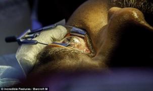 ŞI-A TATUAT OCHIUL! Motivul este INCREDIBIL!