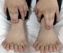 Deși pare că sunt cinci, DE FAPT are șapte DEGETE la mână! Cum e posibil?!