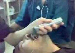 VIDEO INCREDIBIL! Ce au scos medicii irakieni din gura unui pacient