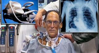 Caz NEMAIÎNTÂLNIT! EL este singurul om care TRĂIEŞTE FĂRĂ INIMĂ