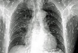 Se plângea de dureri de burtă. La spital a fost OPERATĂ de URGENȚĂ!