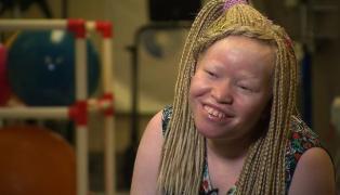 I-au tăiat un picior și două degete. Motivul este ȘOCANT