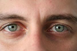 Scapă IMEDIAT de CEARCĂNE şi de RIDURILE din jurul ochilor! Ingredientul e chiar la tine în bucătărie