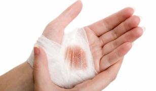 Pansament - MINUNE! Își schimbă culoarea atunci când detectează infecții