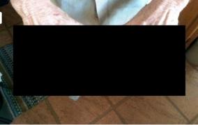 FOTO! Îi ÎNGROZEŞTE pe toţi când le arată DEGETELE de la mâini. "Aşa m-am născut"