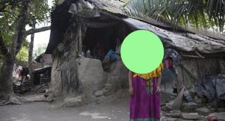 Cutremurător! Ea este tânăra fără FAŢĂ! Nici nu ştie dacă are ochi