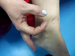 ”Pe aici mi-a intrat glonțul în picior! Pe 17 decembrie 1989, mi-am luat rămas-bun de la tocuri!”