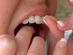 Iată cum poți să îți tratezi CARIILE la tine acasă cu UN SINGUR INGREDIENT