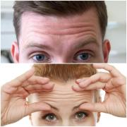 Află detalii dintr-o singură privire! Ce spune FRUNTEA TA despre tine