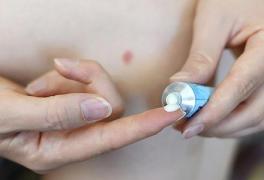 Cum să scapi de PURICI și de PIȘCĂTURILE acestora cu ingrediente din casa ta!