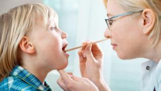 NU ignora semnele! CULOAREA LIMBII trădează anumite probleme de SĂNĂTATE