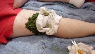 Puțini știu! Ce ți se întâmplă dacă îți pui COMPRESE CU VARZĂ seara, înainte de culcare