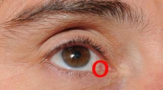 O BOALĂ GRAVĂ ți se poate citi în OCHI