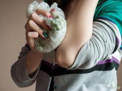 Te-ai lovit și ai rămas cu o VÂNĂTAIE? Iată de ea repede și natural