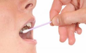 Îți apar AFTE? Ce semnifică apariția lor și cum le poți tratata eficient