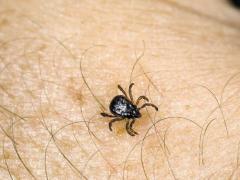 Cea mai eficientă SOLUȚIE împotriva CĂPUȘELOR! O poți prepara singur(ă) acasă