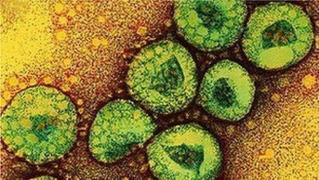 Un al cincilea deces produs de coronavirusul MERS