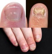 Îți rozi UNGHIILE? Încearcă o metodă eficientă ca să scapi de acest obicei