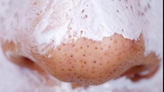 Senzațional! Cum poți ELIMINA punctele negre în câteva secunde