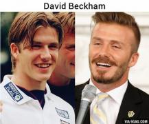 STARURILE de la Hollywood nu au avut mereu ZÂMBETUL PERFECT! Dentiștii s-au chinuit CUMPLIT cu ei! SCHIMĂRI RADICALE!