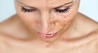 Și-a pus FĂINĂ de orez și suc de LĂMÂIE pe față! Ce s-a întâmplat după este INCREDIBIL!