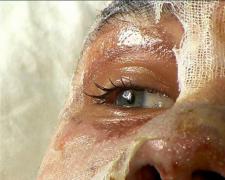 Să nu UITĂM - #Colectiv. “Scriu pentru că am simţit că trăiesc o invazie de oameni arşi din cap până în picioare, fără păr rămas pe cap, cerând ajutor şi apă” – Mesaj sfâşietor postat de un supravieţuitor de la Colectiv