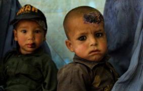 O BOALĂ misterioasă - "Diavolul de Alep" - ar putea ajunge în Europa. Carnea e pur si simplu mâncată de paraziţi. Netratată, poate provoca moartea