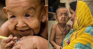 Adevăratul Benjamin Button: Un băieţel de patru ani arată ca un om bătrân. Suferă de o boală extrem de rară care îi îmbătrâneşte corpul de opt ori mai repede decât în mod obişnuit (GALERIE FOTO)