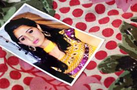 La 19 ani a fost desfigurată. A vrut să se sinucidă. Dar a găsit puterea să meargă mai departe. “Nu ar trebui să judeci o carte după copertă - ar trebui să te uiţi la toată lumea cu aceiaşi ochi” (GALERIE FOTO)