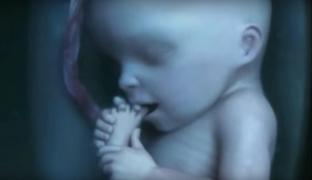 MIRACOLUL VIEŢII: 9 luni de sarcină în 4 minute! VIDEO ULUITOR