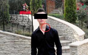 Un tânăr de 17 ani, din Iaşi, şi-a tăiat gâtul pentru o fată