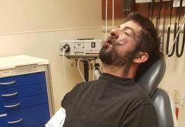 Bărbat mutilat de o țigară electronică. I-a explodat în față!