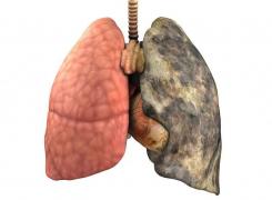 Reţetă pentru detoxifierea plămânilor! Cum să îţi cureţi plămânii dacă eşti fumător!