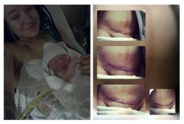 O proaspătă mămică a răbufnit după ce a fost CRITICATĂ pentru că a născut prin CEZARIANĂ: 'Să vă ia naiba! Dacă am născut prin cezariană nu înseamnă că îmi este uşor!'