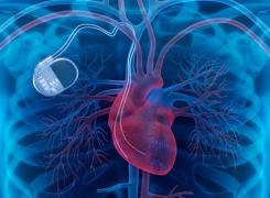 Hackerii îți pot ataca inima! Sute de mii de stimulatoare cardiace sunt vulnerabile la atacuri cibernetice!