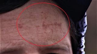 El este tânărul rupt în bătaie de bodyguarzi, după ce a câştigat la pariuri. Băiatul are întipărită în frunte urma unui bocanc mărimea 46 (Video)