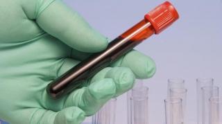 Un adolescent din Bucureşti a vrut să se sinucidă din cauza lipsei imunoglubulinei