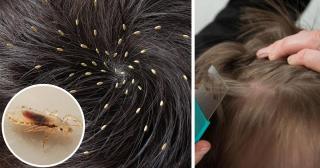 În judeţul Constanţa, foarte mulţi de elevi s-au întors la şcoală BOLNAVI sau cu PĂDUCHI şi RÂIE din vacanţa de iarnă