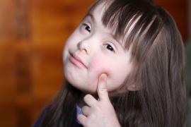 Ordin de ministru INUMAN: Indemnizație tăiată pentru mii de copii cu sindromul Down! (VIDEO)