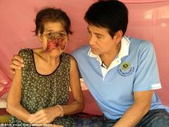 A folosit un leac băbesc pentru o banală duere de dinţi, dar nu-şi închipuia ce avea să păţească! Cu ce s-a ales o femeie în urma unui TRATAMENT GREŞIT