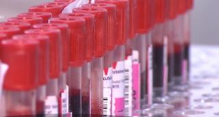 Raport DSP Dolj, la Spitalul din Craiova: Procedurile legate de transfuziile de sânge au fost respectate, pacienţii ar fi murit din alte cauze