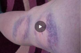 Semnal de alarmă din Todireşti. Elevul huligan, care şi-a bătut profesoara cu ţeava de la calorifer, are aceeaşi atitudine violentã fizic şi verbal fatã de colegi şi sfideazã în continuare cadrele didactice